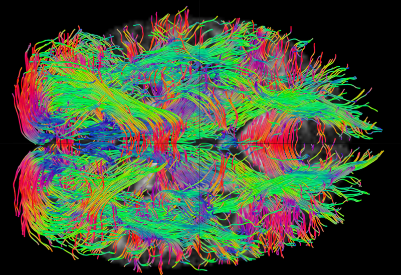 Highly detailed brain scan from the Civitan International Neuroimaging Lab
