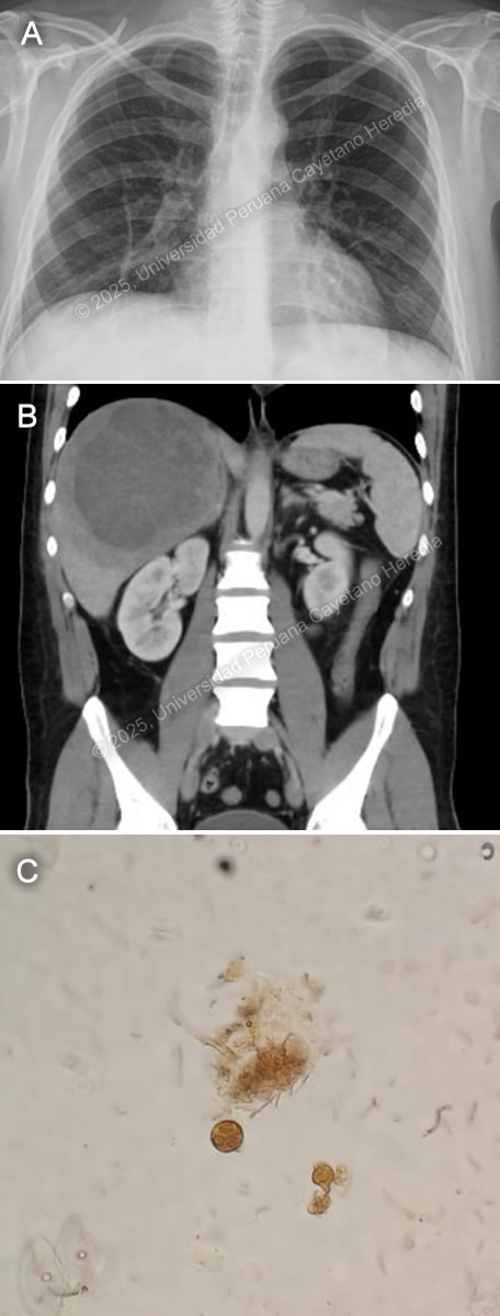 Image for Case 2025-1