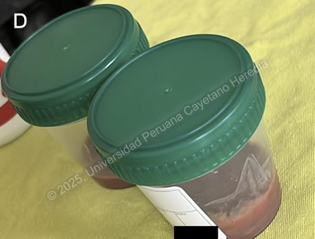 Images for Case 2025-1