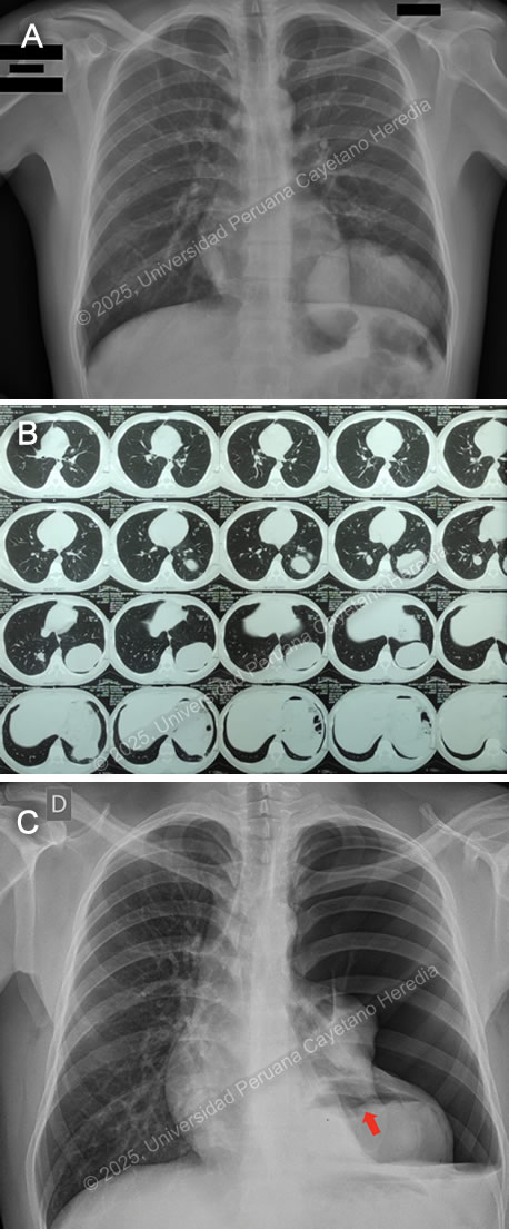 Image for Case 2025-2