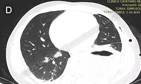 Images for Case 2025-2