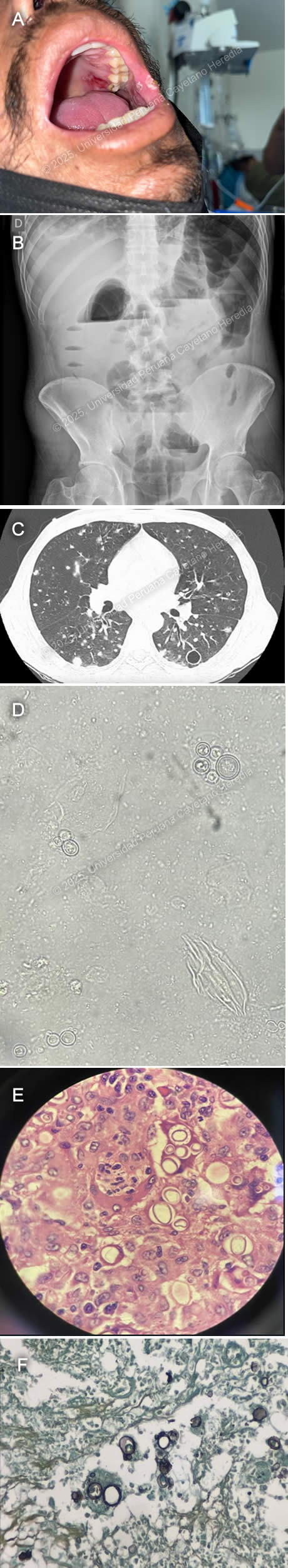 Image for Case 2025-4