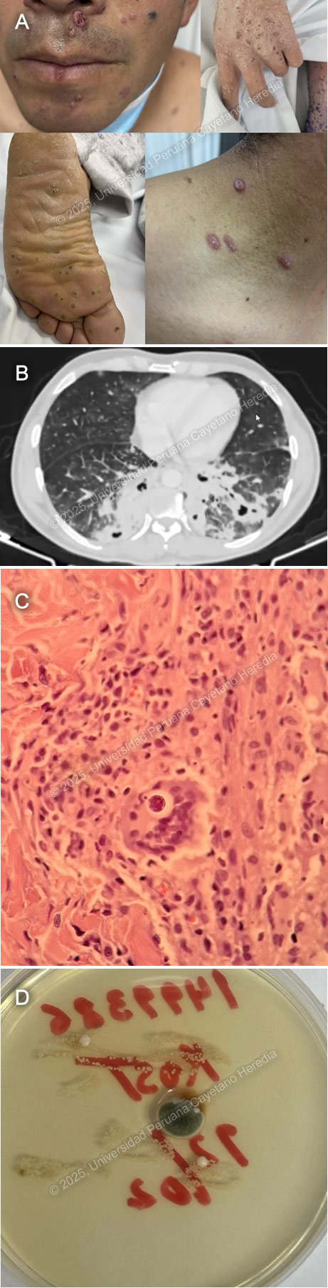 Image for Case 2025-6