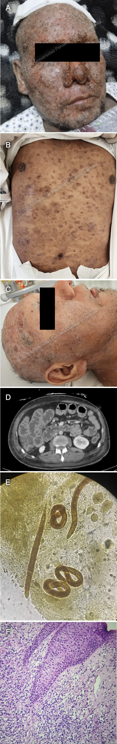 Image for Case 2025-8