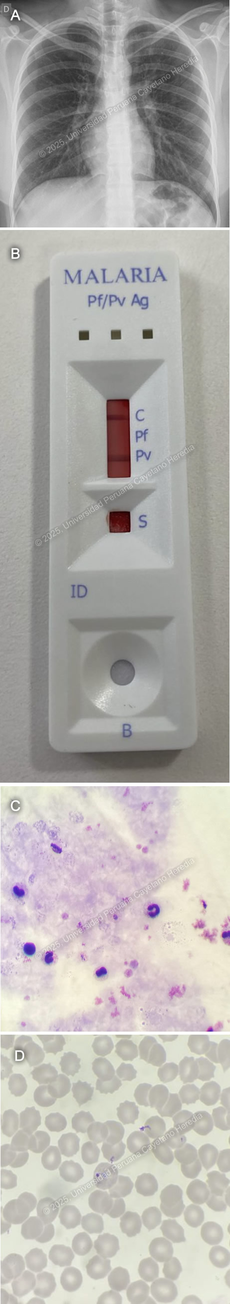 Image for Case 2025-8