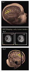 MSI-image3