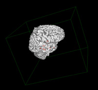 MSI_image2