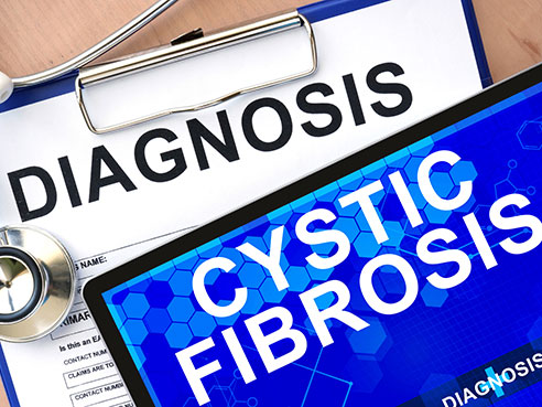 cystic fibrosis
