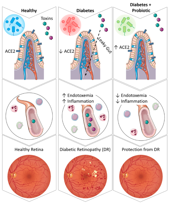 Graphical abstract of the RAS functioning in the gut-eye axis