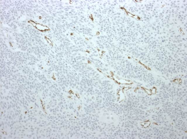 CD31 IHC stain on mouse xenograft paraffin section