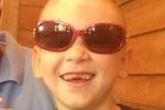 12._Riley-_1_week_after_resection_surgery