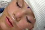 3._Riley-_in_PACU_after_GRID_Placement