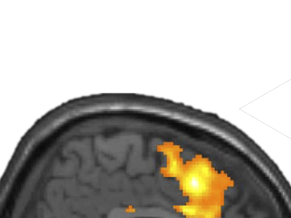 schizophrenia button 112812