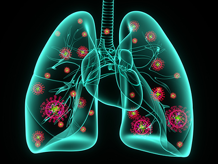 3D Rendering,COVID-19 virus infection of human lungs