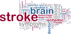 stroke_brain_site