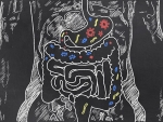 Donor microbes persist up to two years after a fecal transplant to treat recurrent C. difficile infection