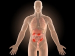 Immune cells that create and sustain chronic inflammatory bowel disease identified