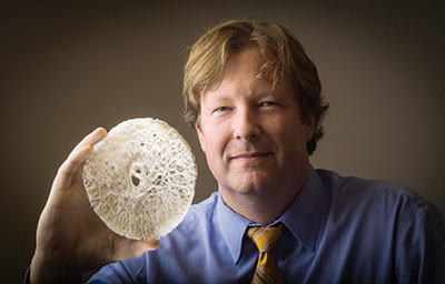 Photo of Crawford Downs holding model of lamina cribosa