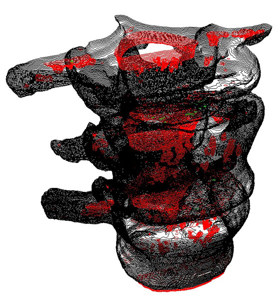 Analysis of the nesting structure of a contour dataset of the spine. 