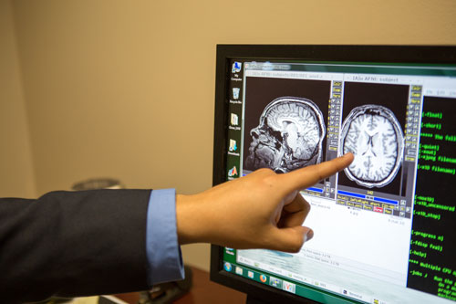 Computer displaying results of an MRI brain scan. 