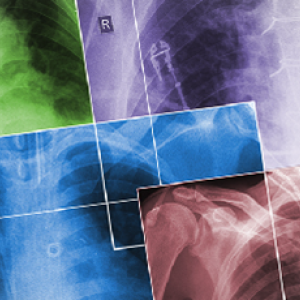 UAB Lung Health Center