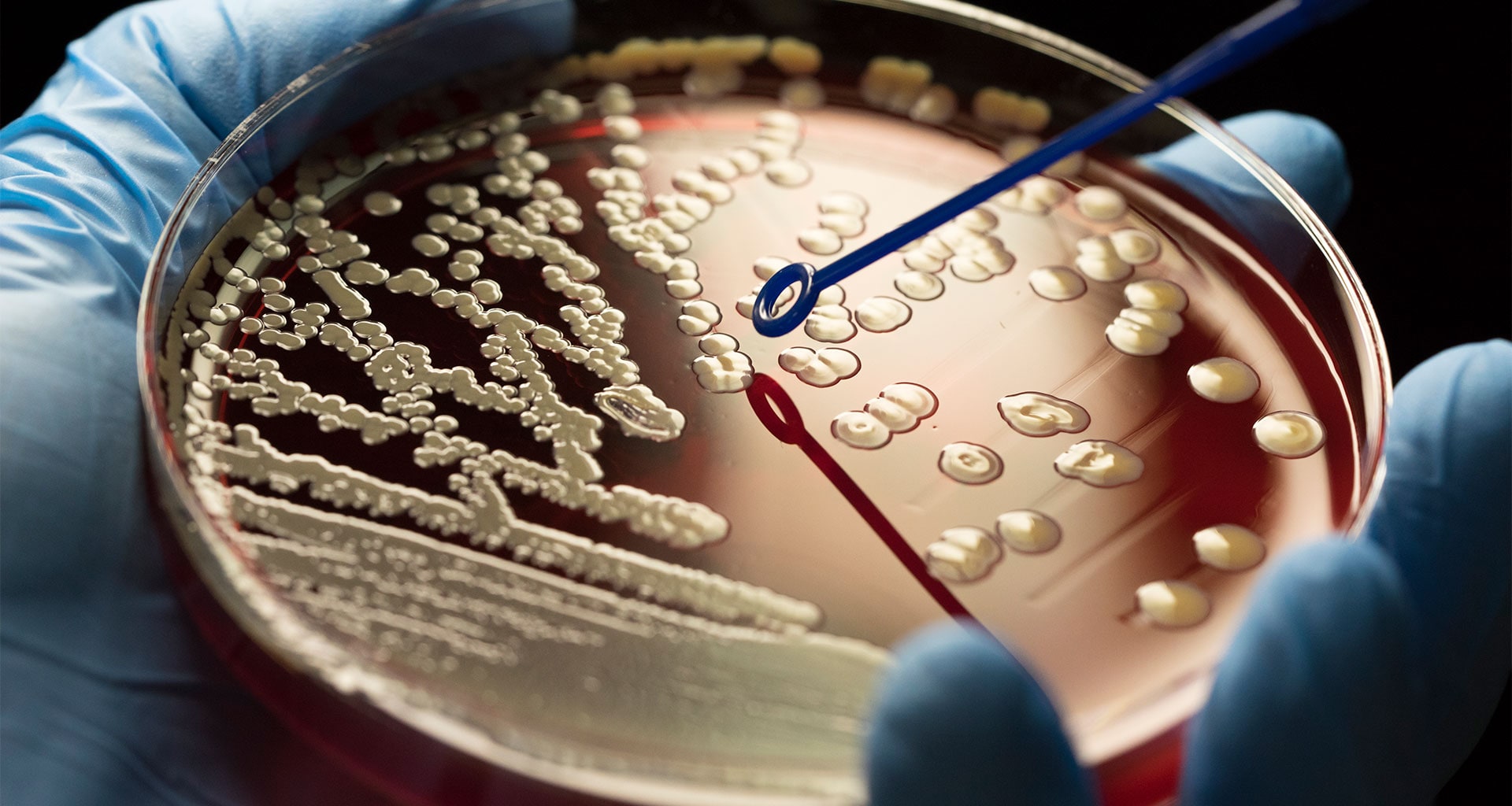 Microbiology, PhD - Find Your Degree | UAB