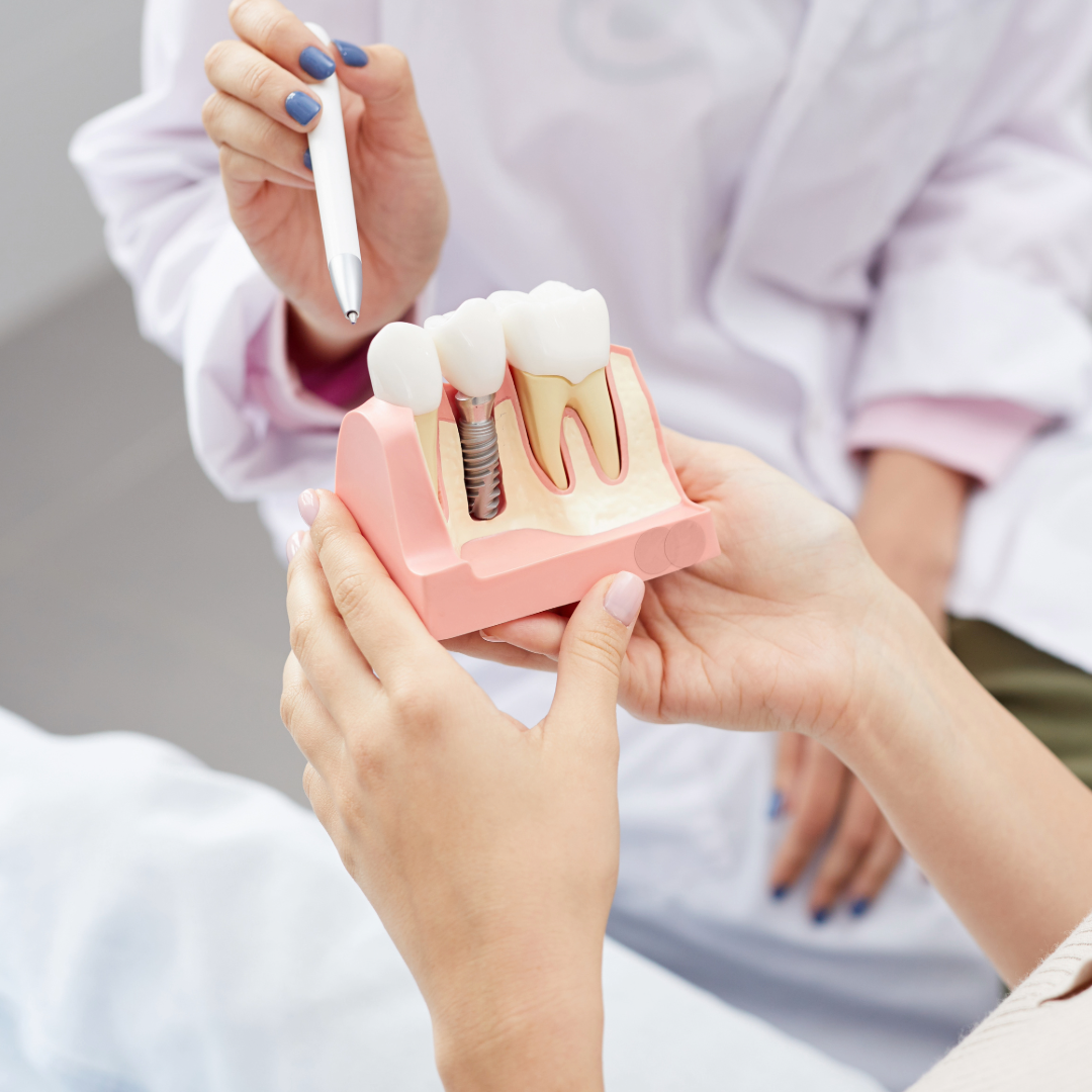 Nation’s First Dental Implant Registry