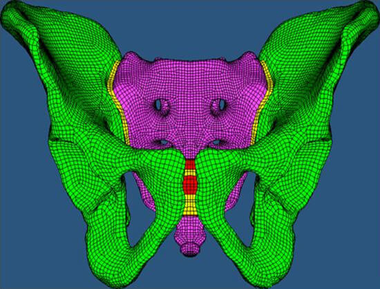 Computer model of a pelvis. 