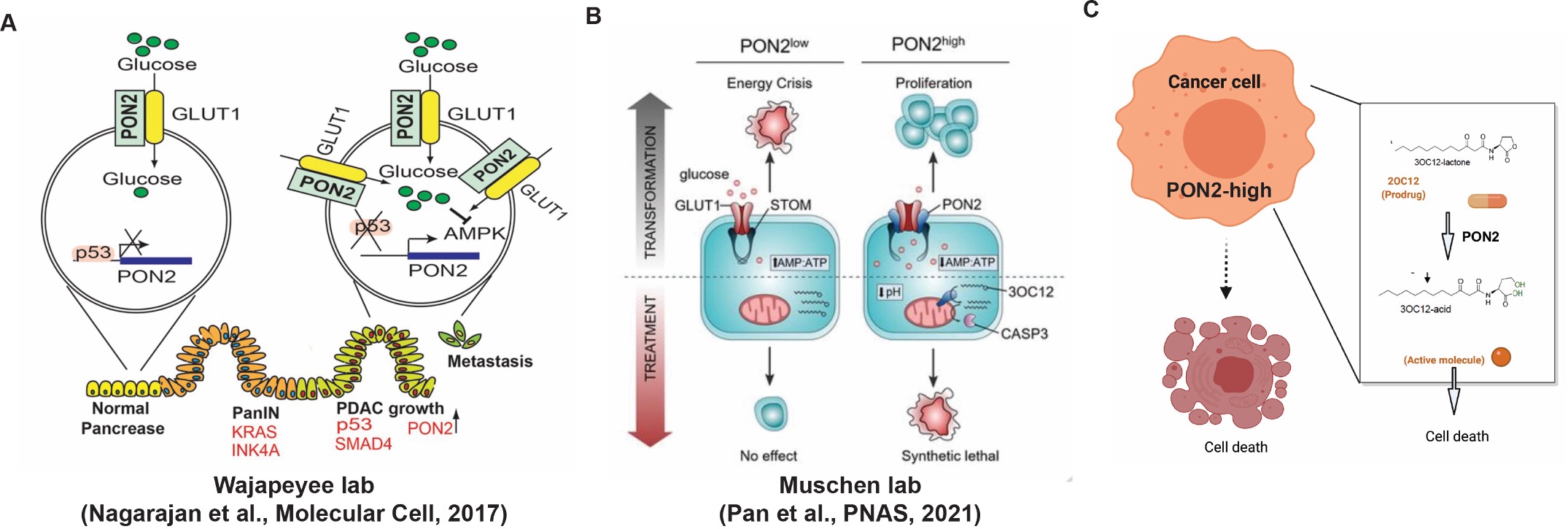 PON2 promotes metabolic survival in pancreatic cancer and acute lymphoblastic leukemia, while its lactonase activity creates a selective therapeutic vulnerability in PON2-high tumors.