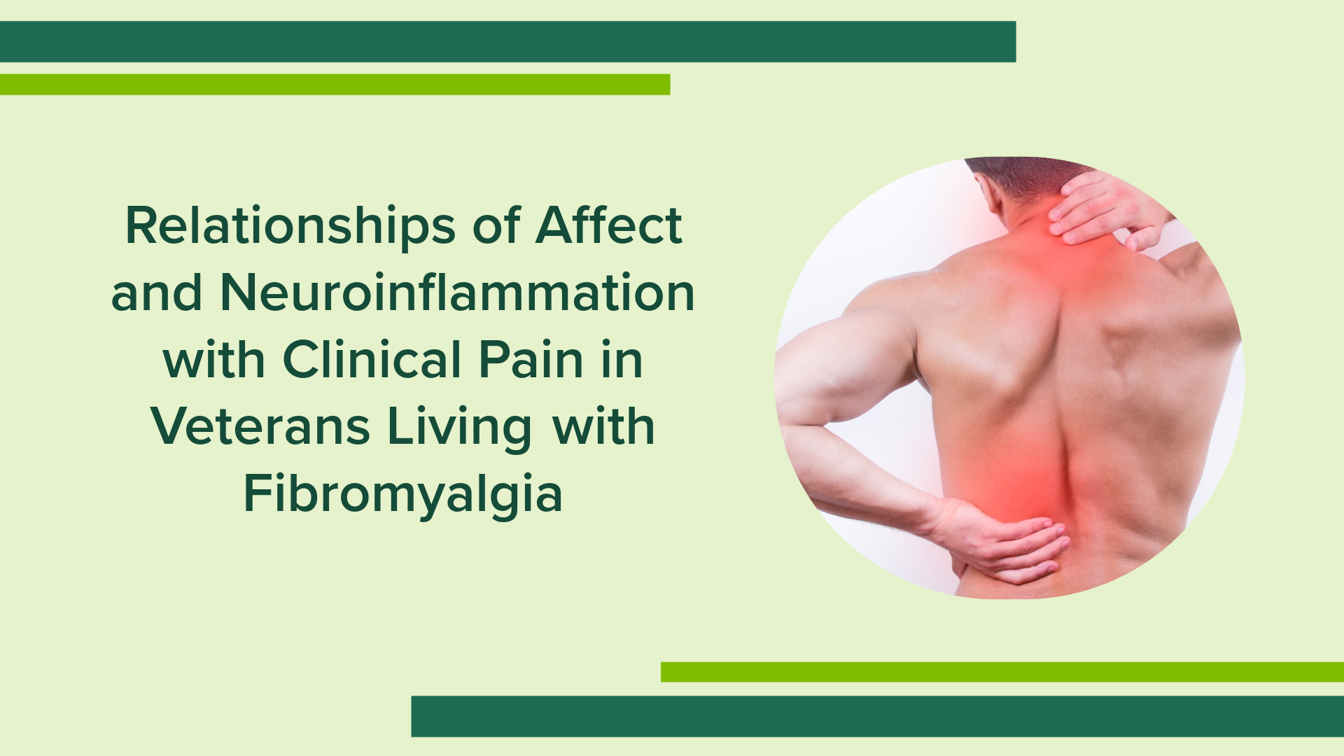 Relationships of Affect and Neuroinflammation with Clinical Pain in Veterans Living with Fibromyalgia