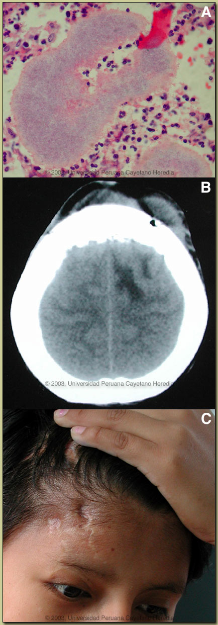 Image for Case 2003-04 Discussion