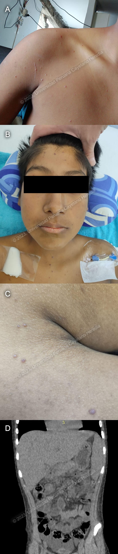 Image for Case 2023-03