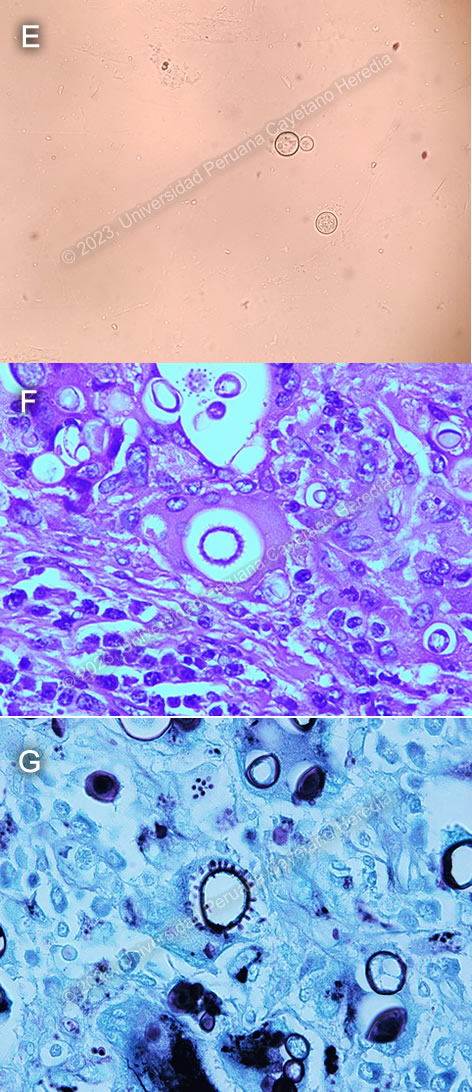 Images for Case 2023-03