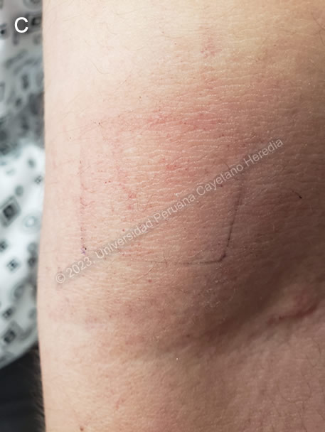 Images for Case 2023-04