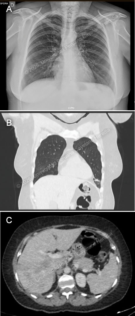 Image for Case 2026-4