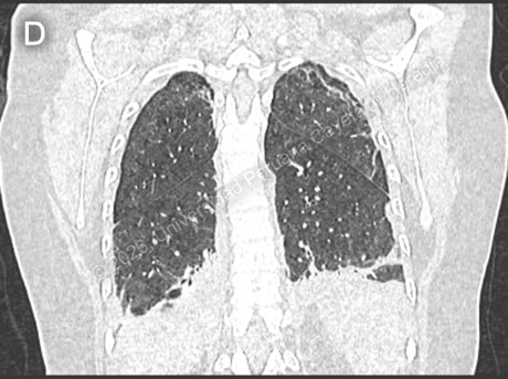 Images for Case 2026-4