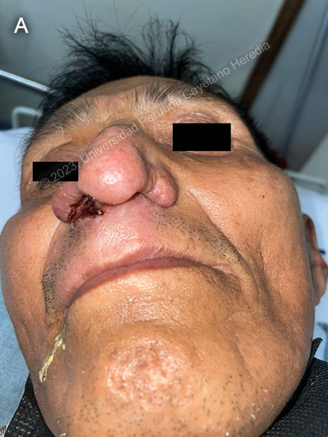 Image for Case 2023-05