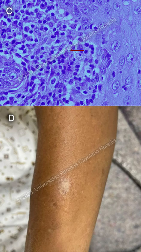 Images for Case 2023-05