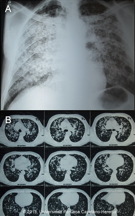 Image for Case 2018-05