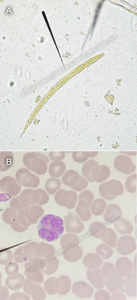 Image for Case 2023-06