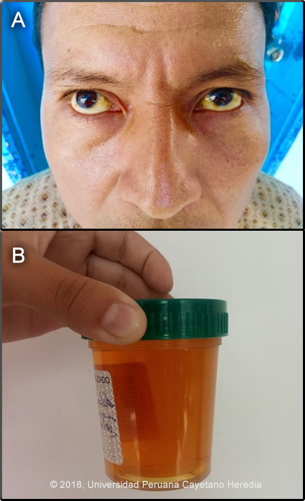 Image for Case 2018-06