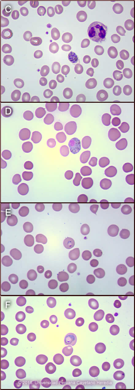 Images for Case 2018-06