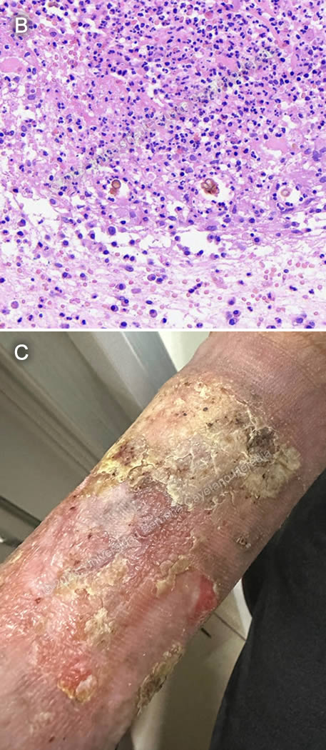 Images for Case 2023-08