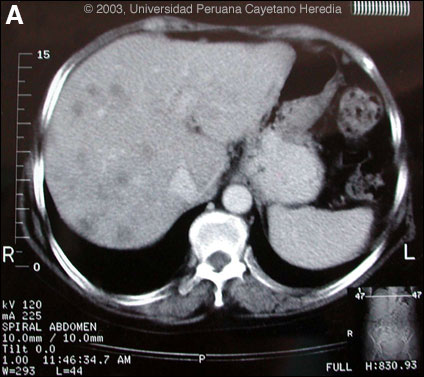 Image A for Case 2003-12
