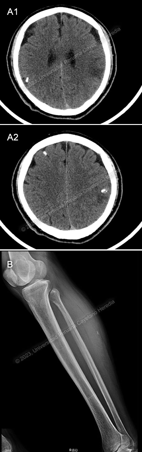 Image for Case 2023-10