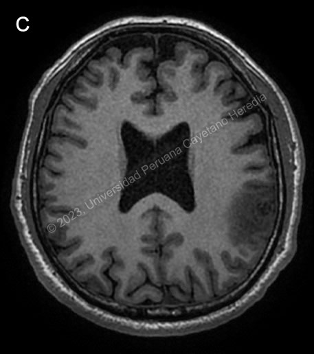 Images for Case 2023-10
