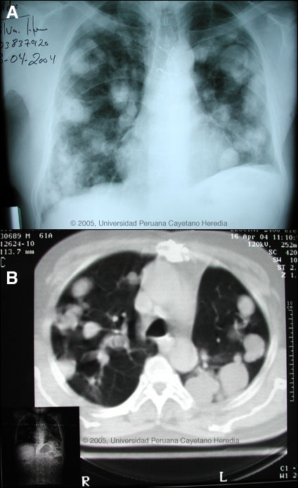Image AB for Case 2005-10