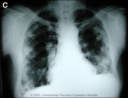 Image C for Case 2005-10
