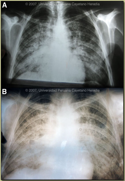 Image AB for 03/02/07