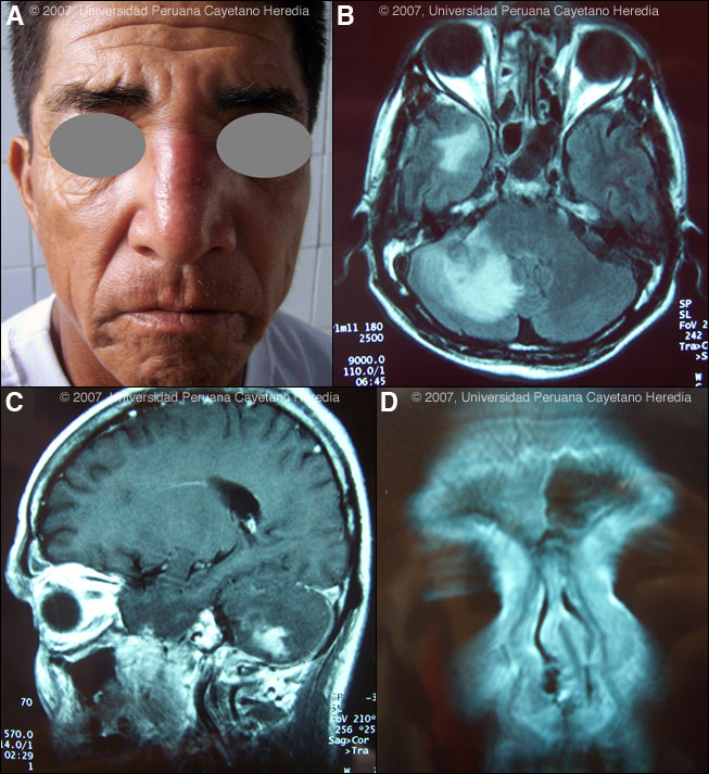 Images ABCD for Case 2007-06